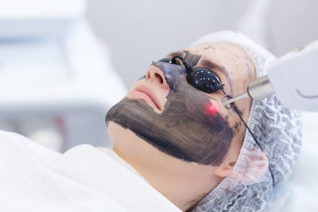 Carbon Laser Carbon Laser @ Derma Lounge Beauty Care Hankash/Hankach street Bauchrieh/Baouchrieh Lebanon